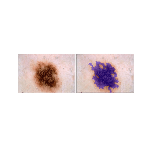 Pretrained Vision Models for Dermascopic Image Analysis